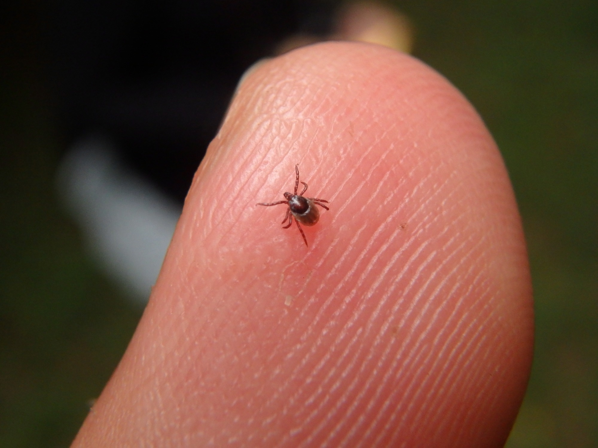 Study: Rocky Mountain Spotted Fever in Children along the US‒Mexico Border, 2017–2023. Image Credit: David Jara Bogunya/Shutterstock.com