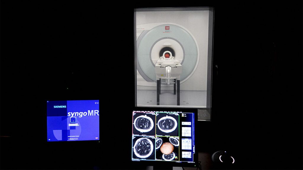 MRI brain scans displayed on monitor with MRI scanner in the background