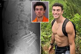 Luigi Mangione’s back pain was so intense that he couldn’t be ‘physically intimate’ with anyone, former landlord says