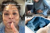 Collage of a woman and a man, representing a colon cancer survivor sharing ignored signs